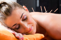 Woman at acupuncture needles in back